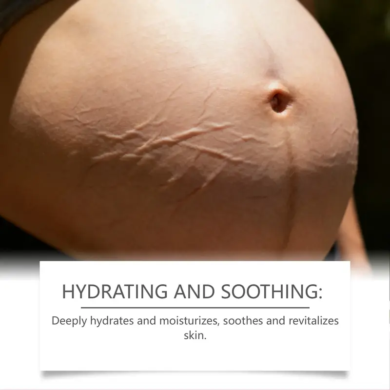 Crème Anti-Vergetures Grossesse | Peau Lisse & Hydratée | Mybooni