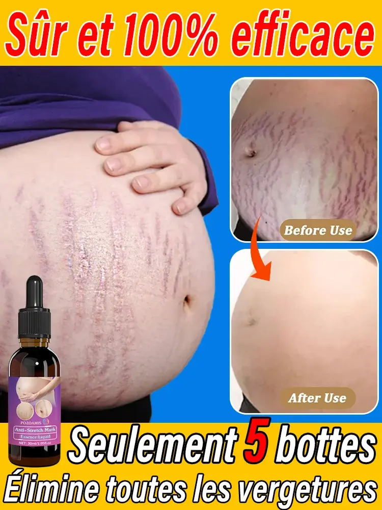 Huile essentielle corps anti-vergetures pour femmes enceintes hydratante apaisante