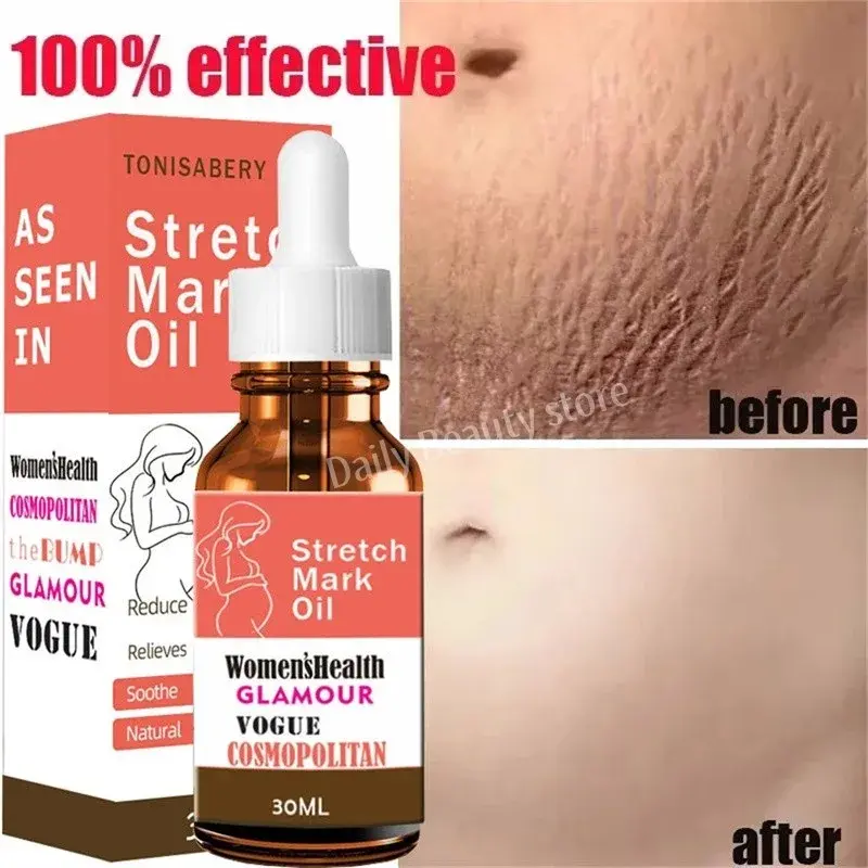 Huile sérum anti-vergetures maternité nouvelle et ancienne améliore l'élasticité